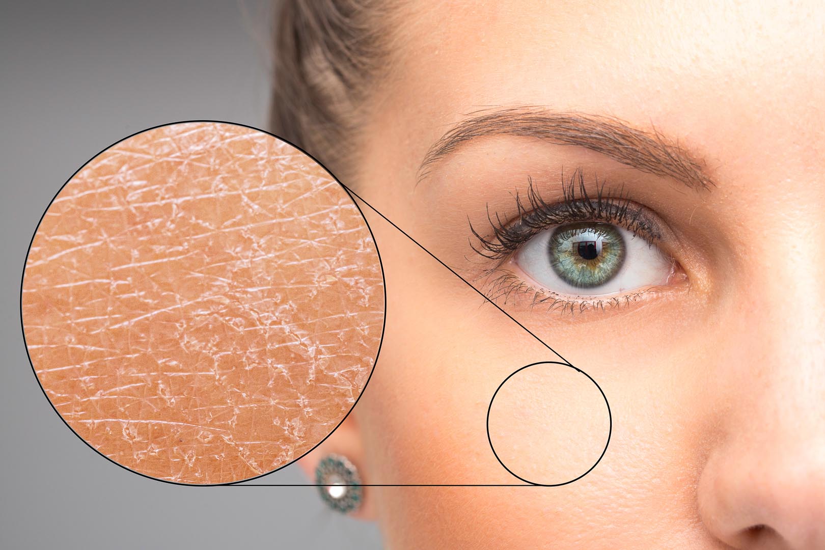 A,Magnified,Macro,Detailed,Circle,Is,Seen,Over,The,Cheek